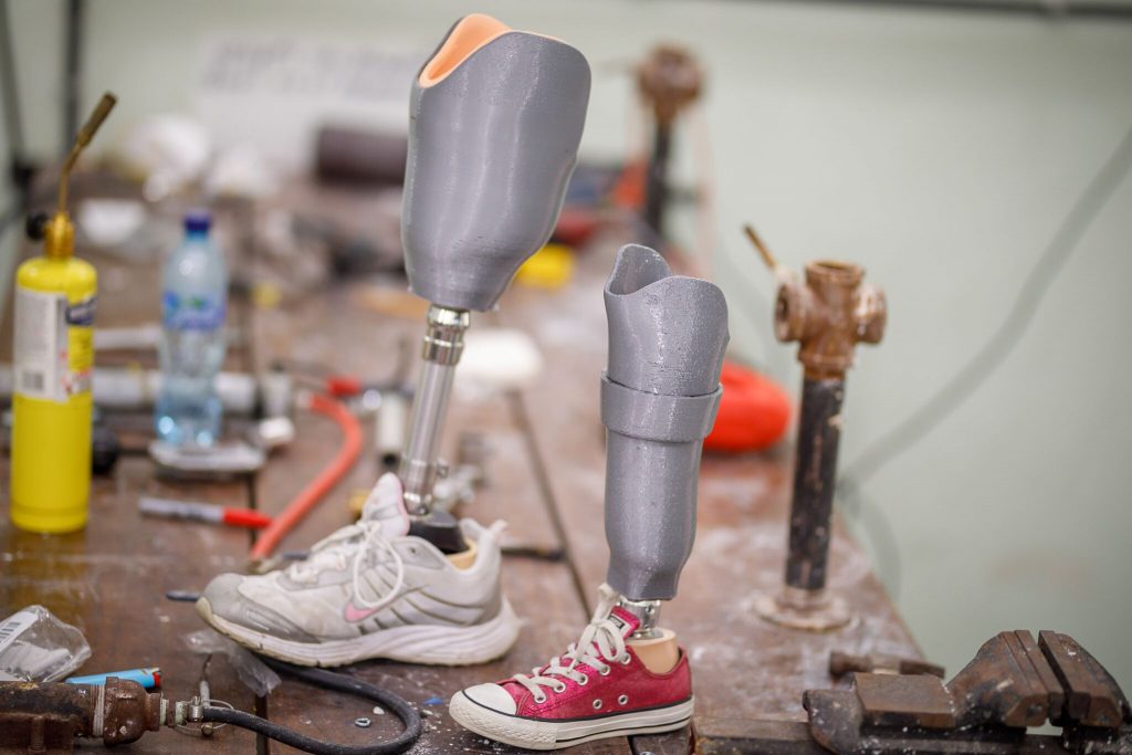 Interview with Prosthetist and Orthotist Brent Wright of LifeEnabled on 3D  Printing Prosthetics - 3DPrint.com | The Voice of 3D Printing / Additive  Manufacturing