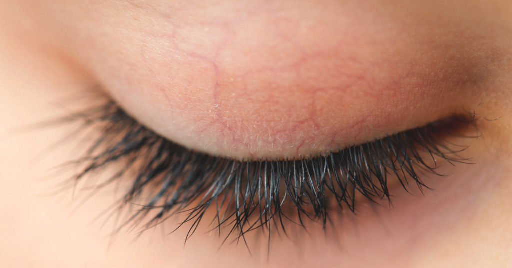 3 Things You Can Do If You Lose Your Lashes During Chemo