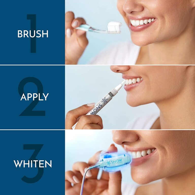 DIY Kits For A Set Of White Teeth