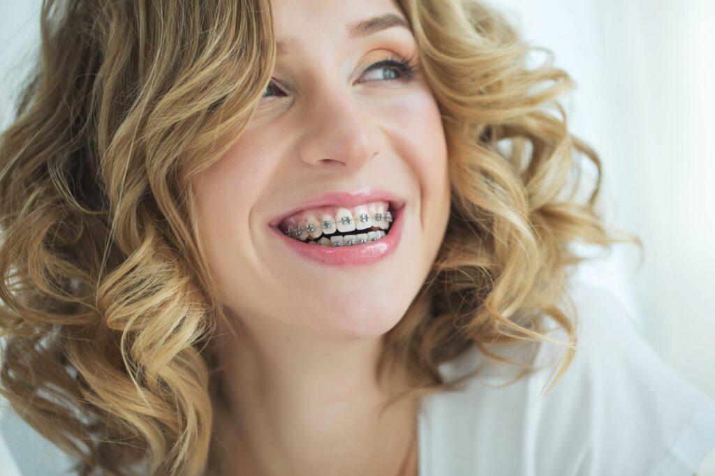 On a Budget 5 Ways to Get Affordable Braces