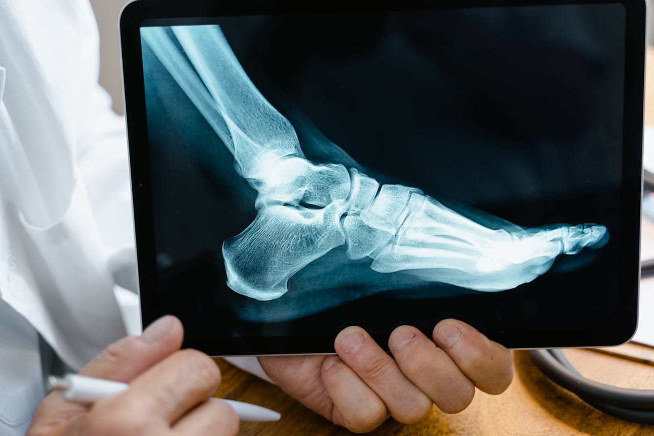 What You Need to Know About Old Ankle and Foot Injuries | My Zeo 15. What You Need to Know About Old Ankle and Foot Injuries.jpg