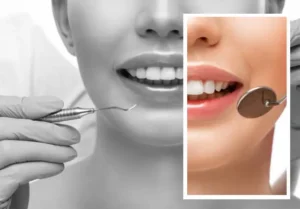 4 Common Cosmetic Dental Treatments Explained Simply | My Zeo 