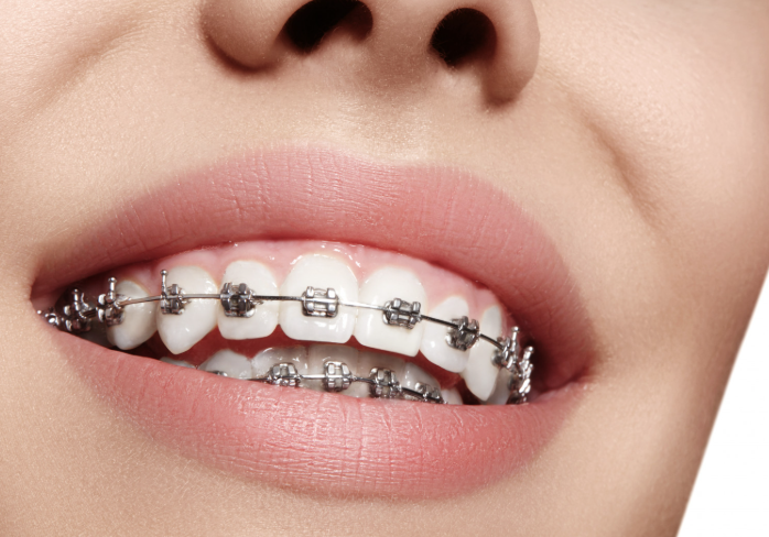 5 Benefits Of Regular Visits To Your Orthodontist | My Zeo 