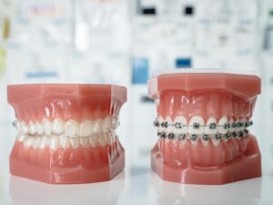 the role of preventive care in lowering orthodontic treatment needs | my zeo