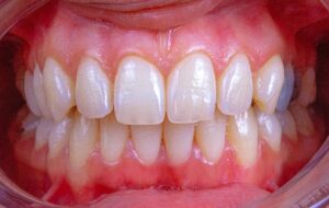 5 steps general dentists take to improve oral health outcomes | my zeo