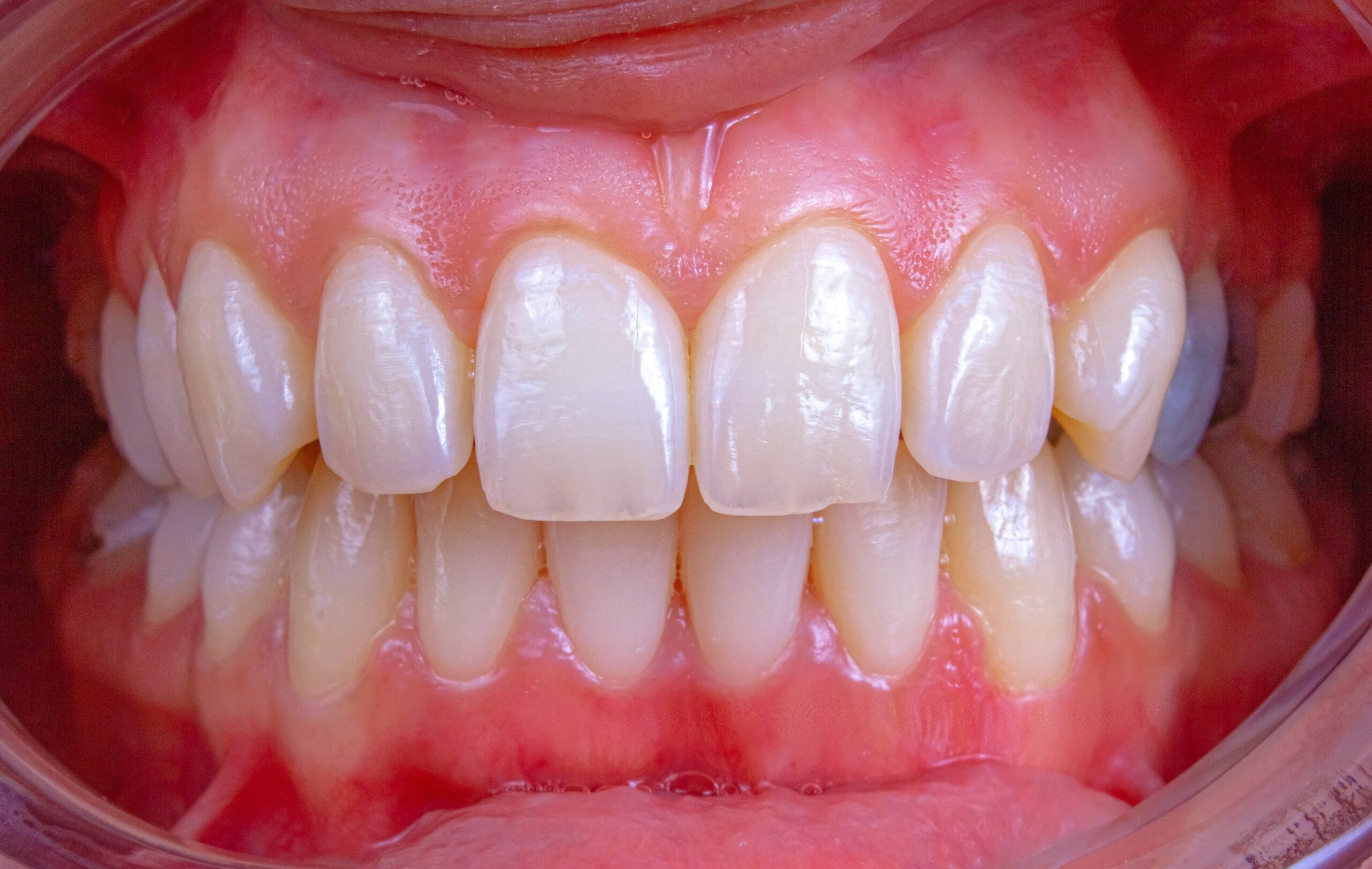 5 Common Myths About Gum Disease Debunked | My Zeo 5 common myths about gum disease debunked | my zeo