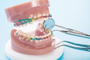 3 key questions to ask your orthodontist before treatment | my zeo