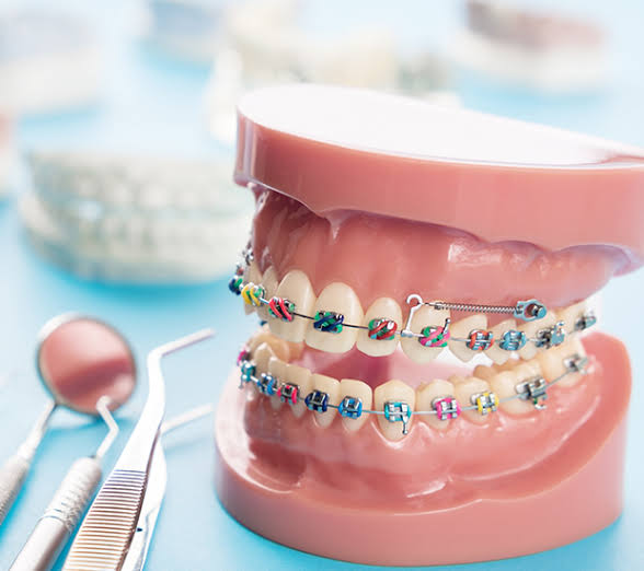 the role of orthodontics in guiding childrens dental development | my zeo