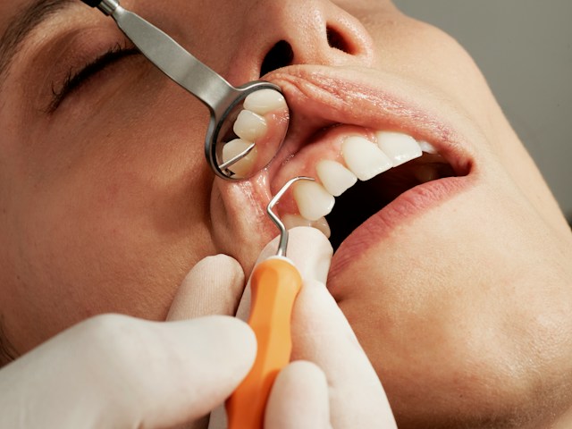 3 Reasons Preventive Dental Care Should Always Come Before Cosmetic Dental Work 3 reasons preventive dental care should always come before cosmetic dental work | my zeo